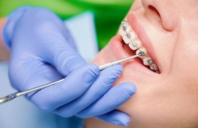 স্মাইল ডেন্টাল কেয়ারে সেবার পর সন্তুষ্ট রোগীর হাসি